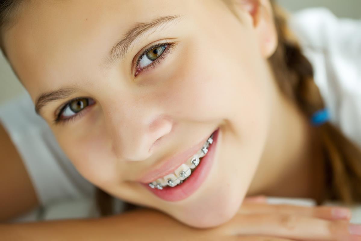 orthodontic services Anthem, AZ